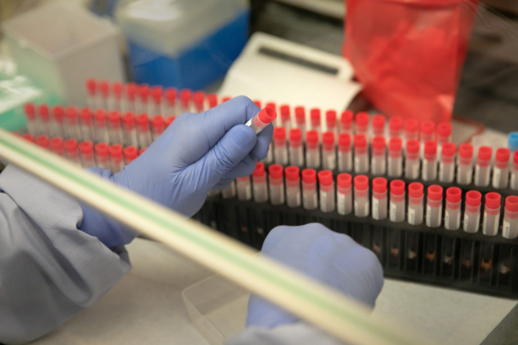 A medical laboratory scientist tests samples for coronavirus at the University of Washington Medicine virology lab on March 13, 2020, in Seattle. (Photo by John Moore/Getty Images)